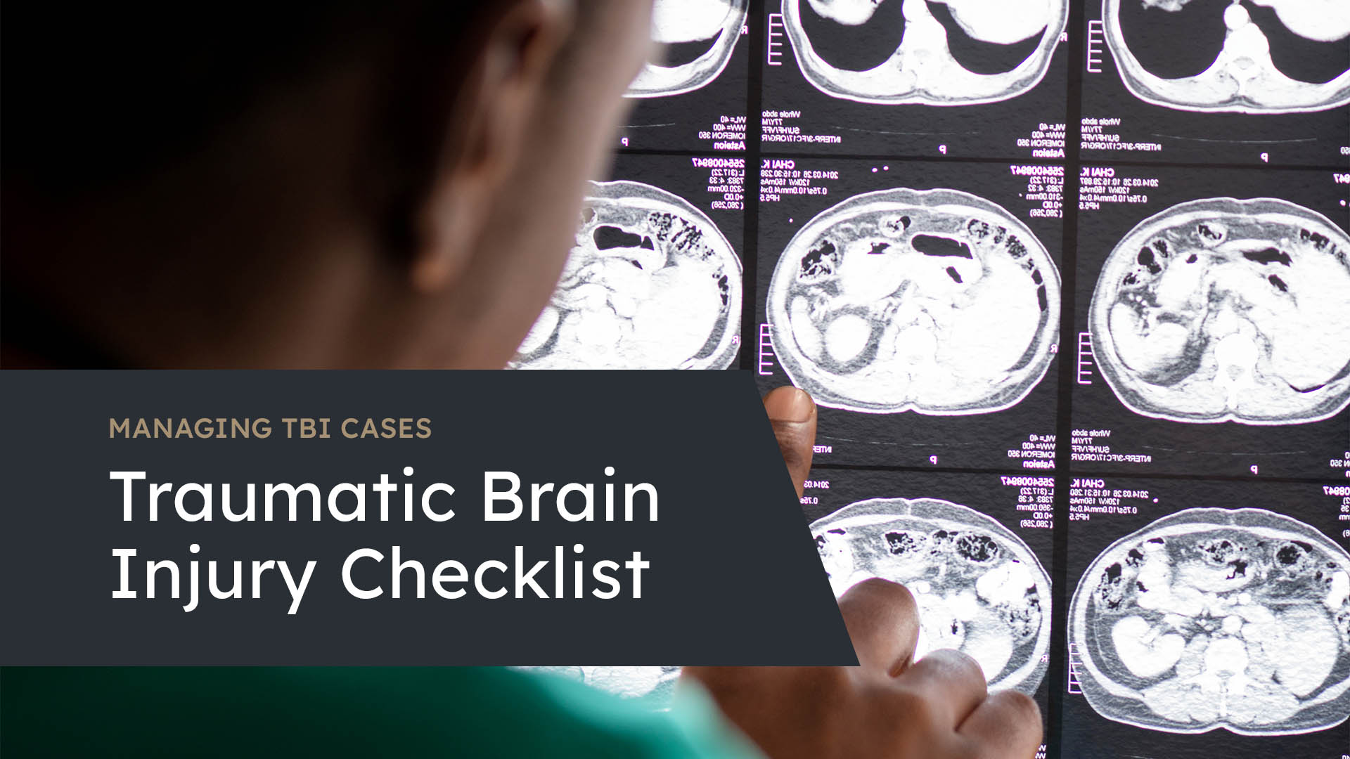 Guide To Imaging Tests In Personal Injury Cases